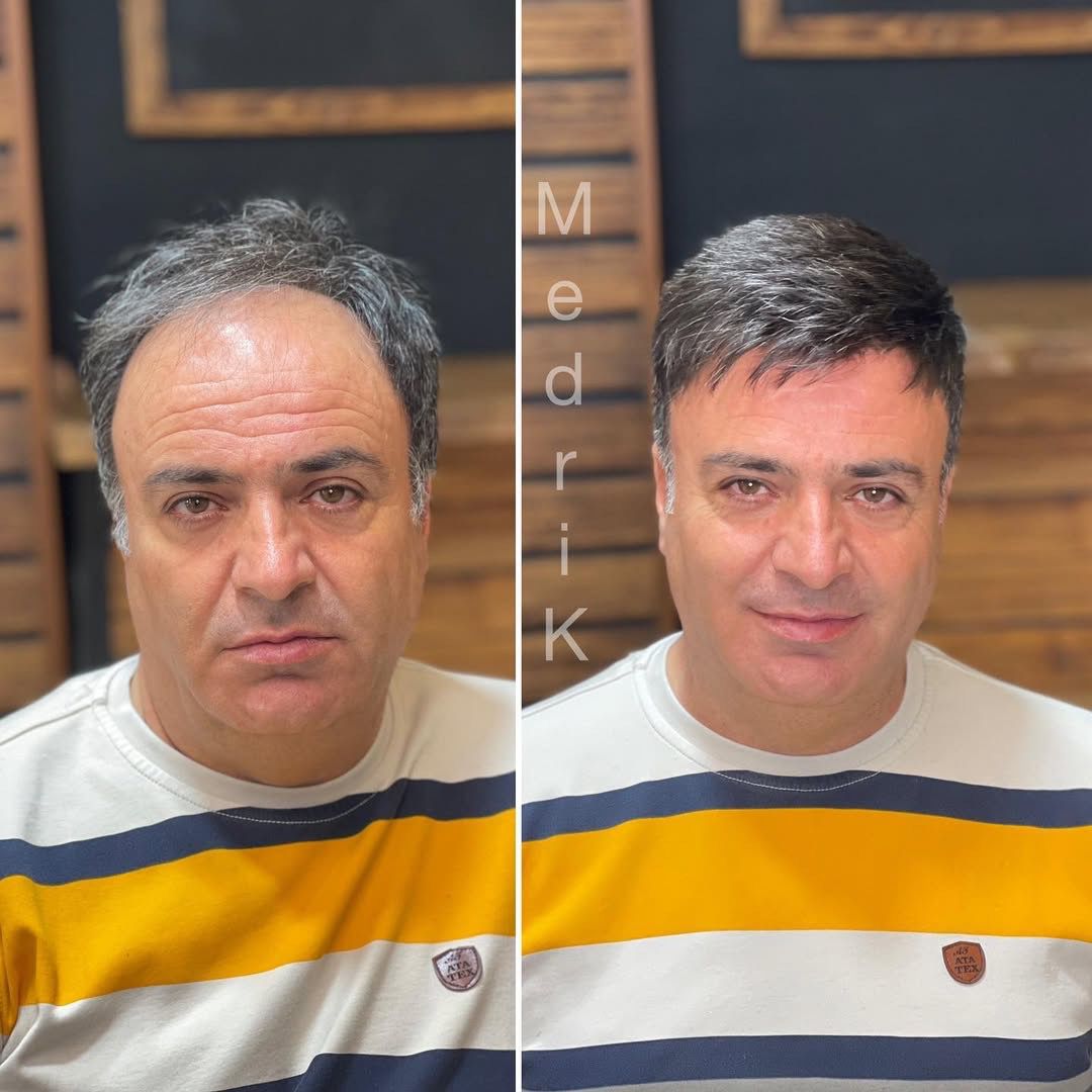 Feel Confident, Look Amazing with the Right Wig